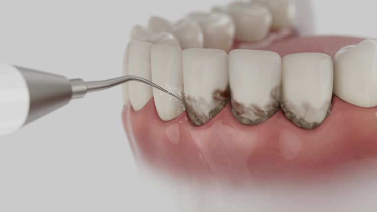 Reliable Dental Implants contractor in Denver, CO by Smile Center Dentistry